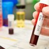 Como 429 pessoas no Congo controlaram o HIV sem medicamentos? congo-hiv-tratamento-medicamento-saude2