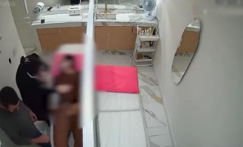 Imagens mostram momento homem submetido peeling fenol começa passar mal